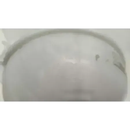 Vase expansion volkswagen tiguan